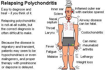 Relapsing Polychondritis